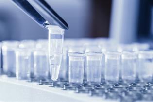 image for The lowdown on Legionella testing