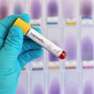 image for Test your Legionella knowledge